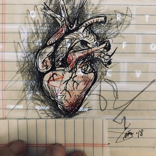 Dynamic Heart